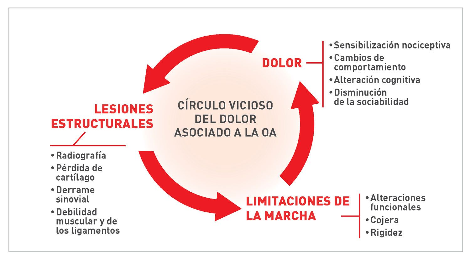Entender el dolor en la osteoartritis
