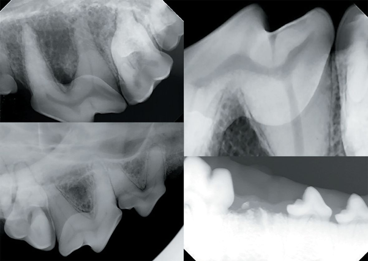 Veterinary dental radiology 