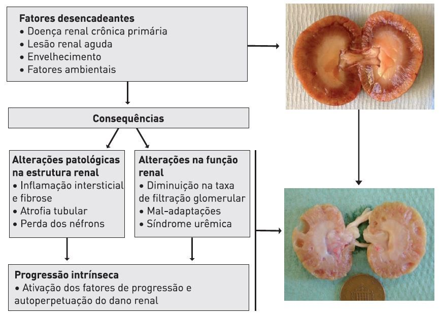 O mecanismo proposto geralmente aceito para o início e a progressão da doença renal crônica. Os fatores desencadeantes levam a “consequências”: alterações na estrutura e função renal. À medida que a doença renal evolui e ocorre uma perda significativa dos néfrons, as respostas mal-adaptativas intrínsecas ao gato contribuem ainda mais para o dano aos rins e a perda dos néfrons. As imagens dos rins dissecados ilustram um rim saudável (figura de cima) e outro rim com doença renal crônica em estágio terminal (figura de baixo).