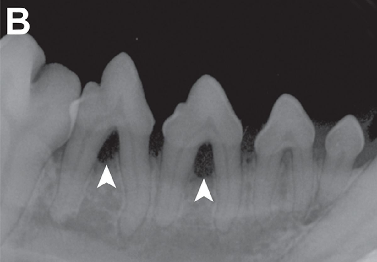 An intraoral dental radiograph (right premolar view, bisecting angle technique) shows severe periodontitis characterized by furcation exposure of the third and fourth premolar teeth (arrowheads). These teeth were extracted without complication, along with several other teeth due to severe periodontitis.