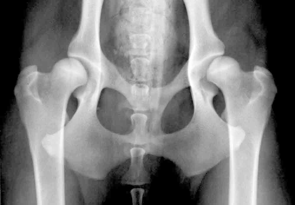 Diese Röntgenaufnahme zeigt eine hochgradige, beidseitige Hüftgelenksdysplasie bei einem 14 Monate alten Hovawart