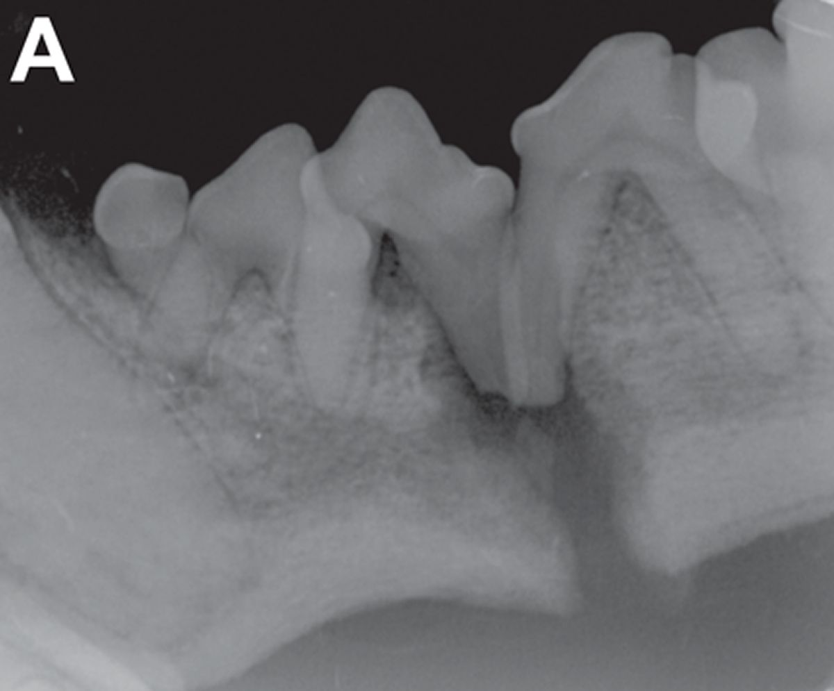 A 6-year-old Pug was presented with a two-month history of suspected oral pain. Intraoral dental radiography (left mandibular premolar view, bisecting angle technique) revealed a complete, transverse, early defect non-union mandibular fracture through the alveolus of the distal root of the left mandibular third premolar tooth and the mesial root of the left mandibular fourth premolar tooth. The premolar teeth are crowded, and there is total loss of attachment of the roots in the fracture line. The fracture is suspected to be secondary to severe periodontitis, likely accelerated by the crowding and rotation of these teeth.