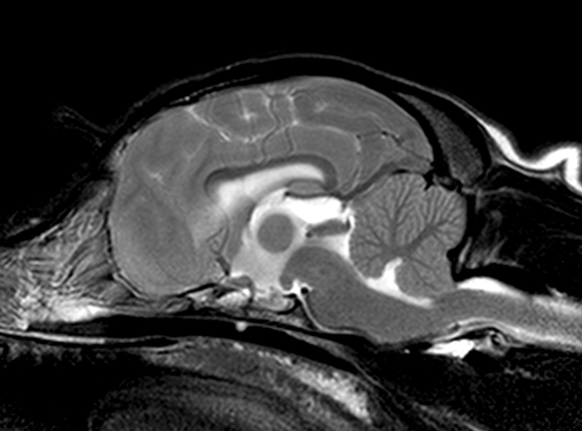 IRM d’un chien atteint de malformation de type Chiari montrant une hernie du cervelet au travers du foramen magnum.