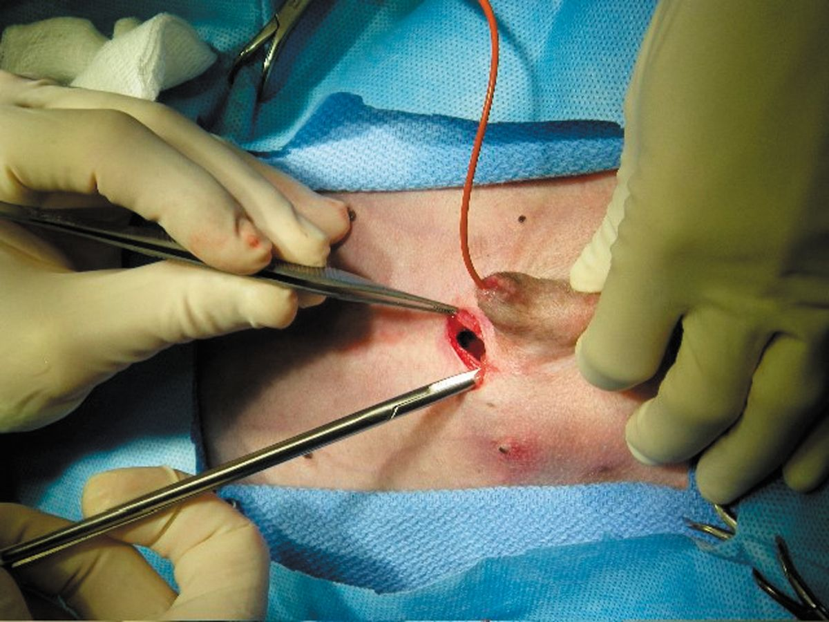 Cistolitotomia percutanea in cane maschio. In corrispondenza dell'apice della vescica si esegue un'incisione di 1,5 cm.