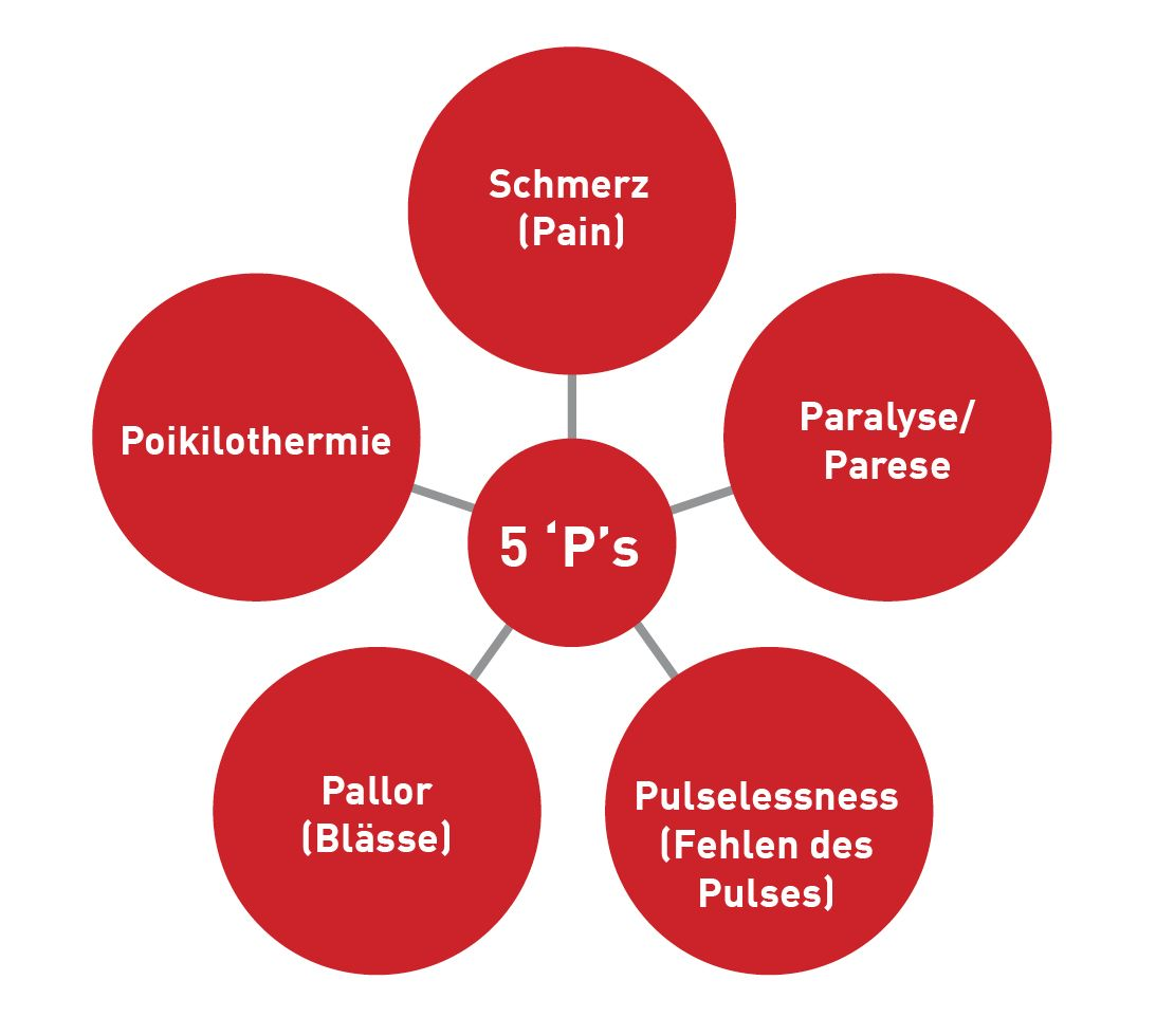 Die 5 ‘P’s
