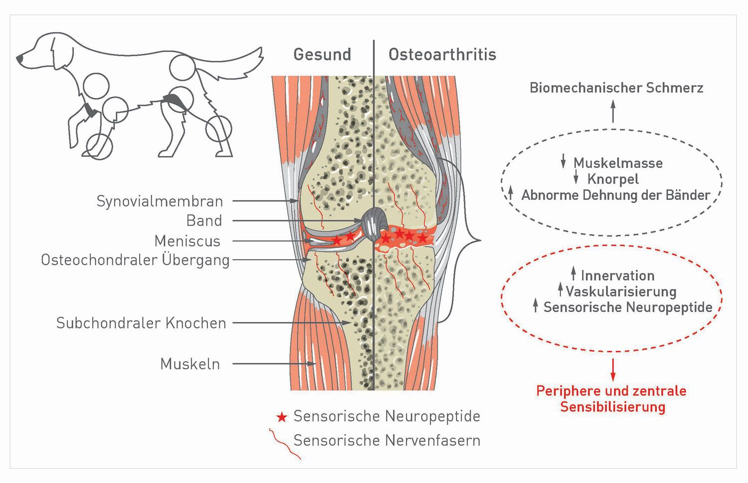Schematischer Überblick über ein gesundes und ein osteoarthritisches Gelenk