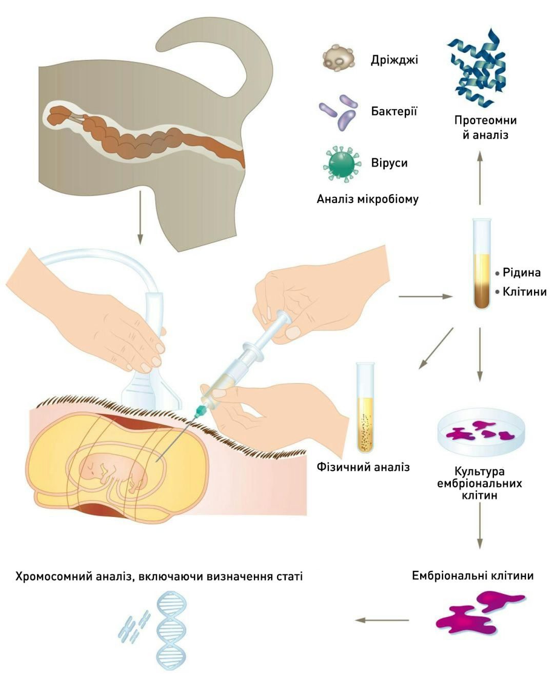 Рисунок 3. Центез плодової рідини можна застосовувати з низкою діагностичних та дослідницьких цілей
