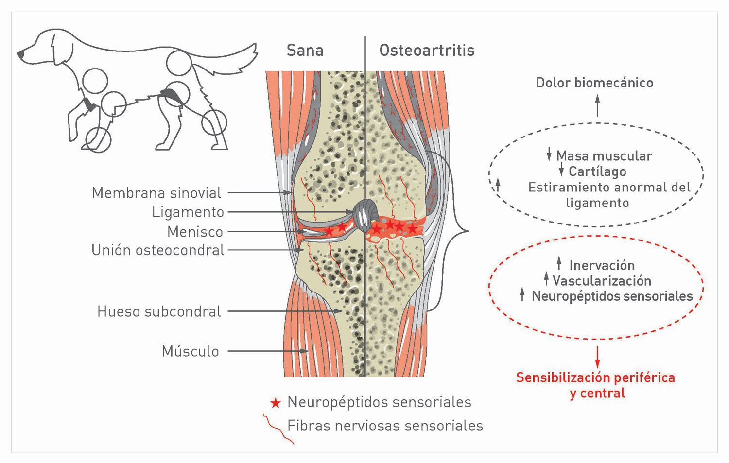 Vista general esquemática de una articulación sana y osteoartrítica