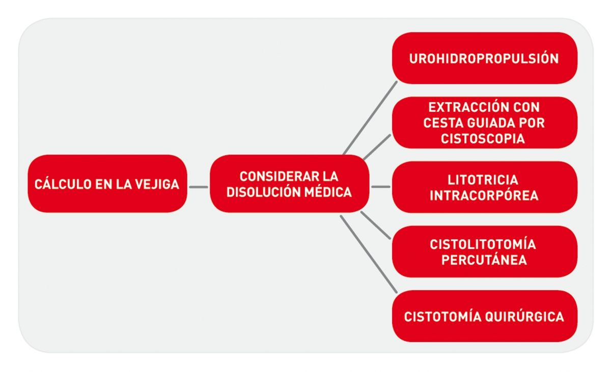Diagrama de decisión para orientar las posibles opciones de eliminación de cálculos en la vejiga.