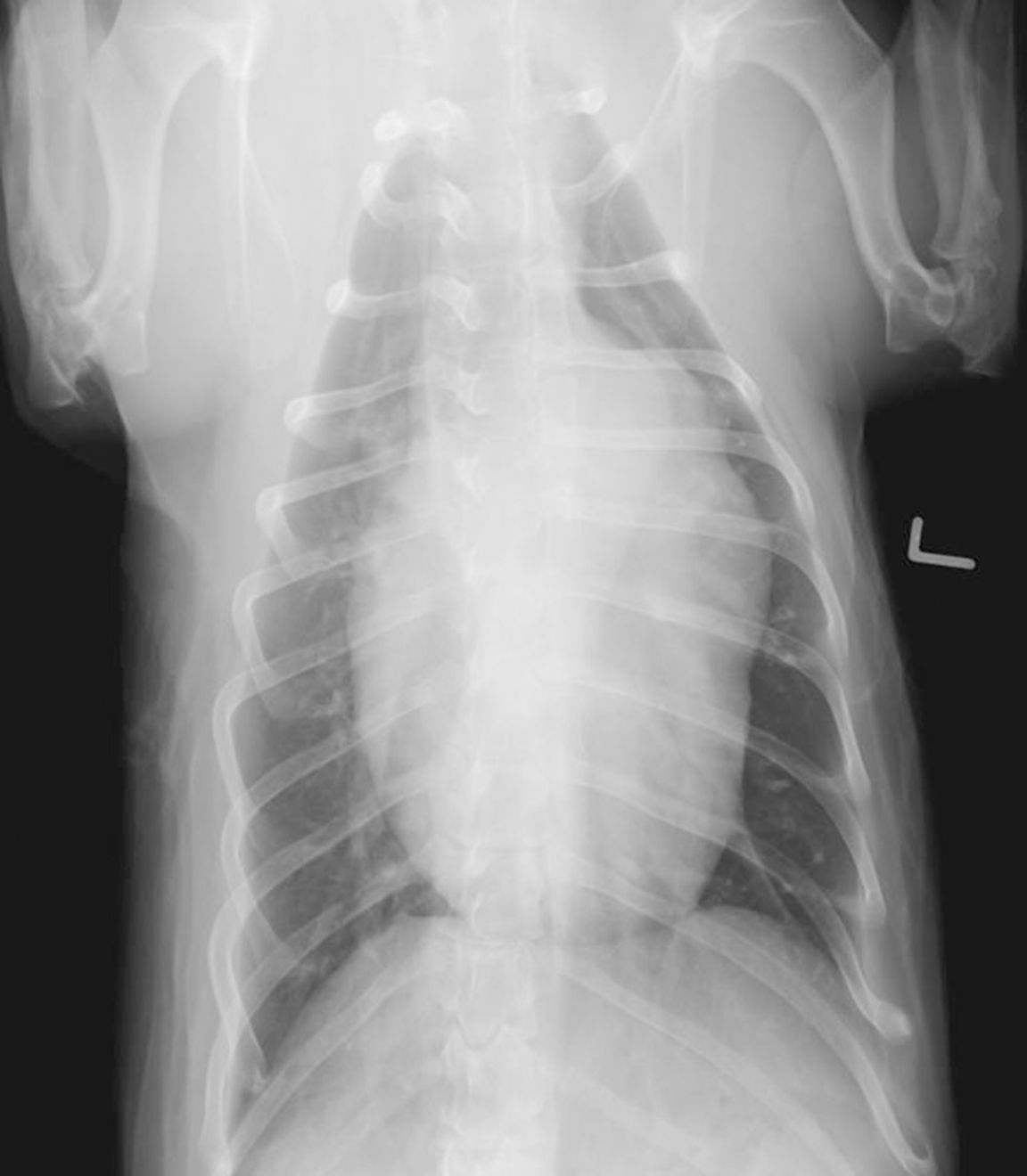 Figure 4. Radiographie thoracique dorso-ventrale chez un chiot souffrant de PCA