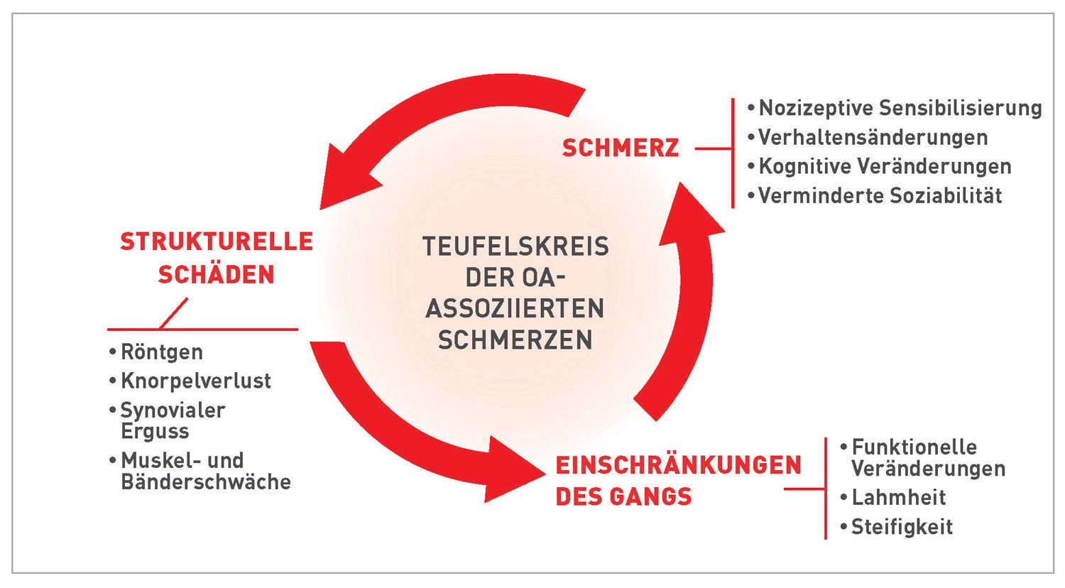 Schmerzen bei Osteoarthritis verstehen 