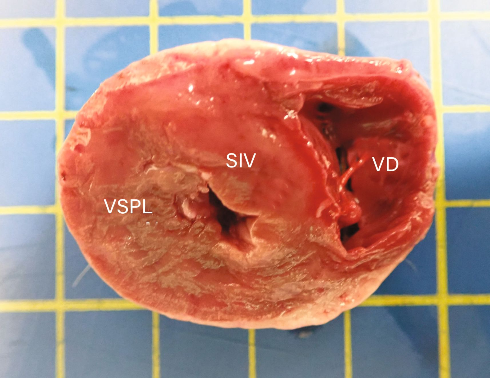  Modelul hipertrofiei VS în cardiomiopatia hipertrofică felină poate să varieze foarte mult de la un individ la altul
