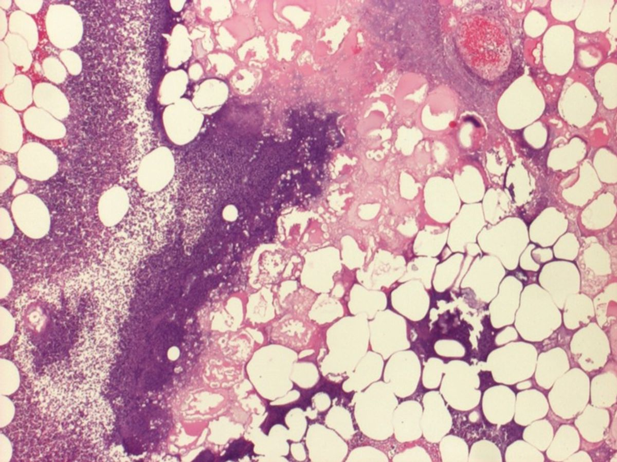 Canine Pancreatitis Diagnosis and Signs Vet Focus