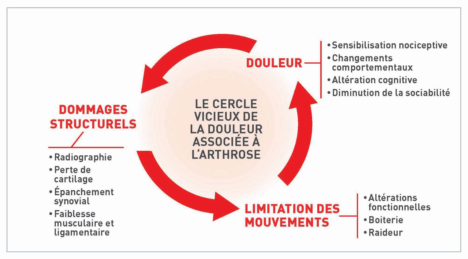 Infographie pour comprendre la douleur liée à l’arthrose