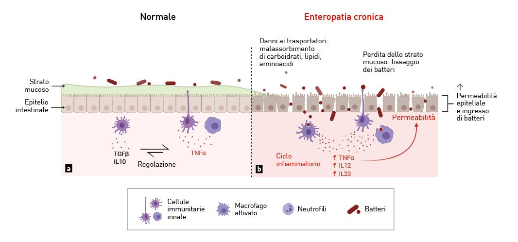 Il tratto intestinale normale e patologico