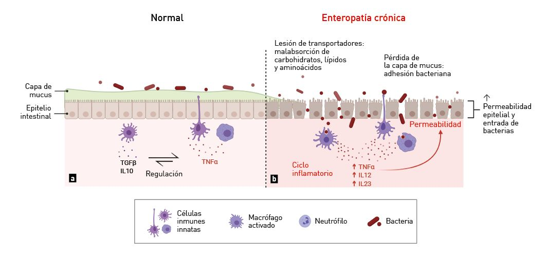 El tracto intestinal sano y enfermo