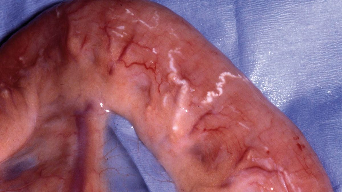 Canine protein-losing enteropathies