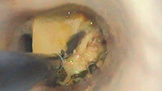 Gastrointestinal endoscopy in dogs