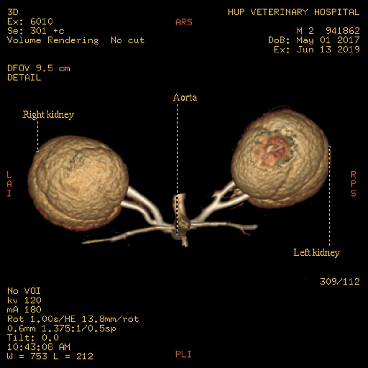 CT– Angiographie einer potenziellen Spenderkatze für eine Nierentransplantation. Die arterielle Phase identifiziert je eine einzelne Arterie rechts und links auf Höhe der Aorta. Beide Arterien bilden vor Eintritt in die Niere eine Bifurkation. Die linke Niere ist besser als Spenderniere geeignet, da der aus der Aorta entspringende ungeteilte Abschnitt der Arterie länger als 0,5 cm ist.