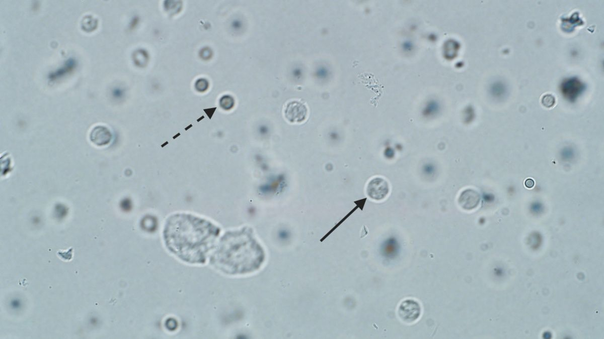 Definición y manejo de las infecciones urinarias en el perro