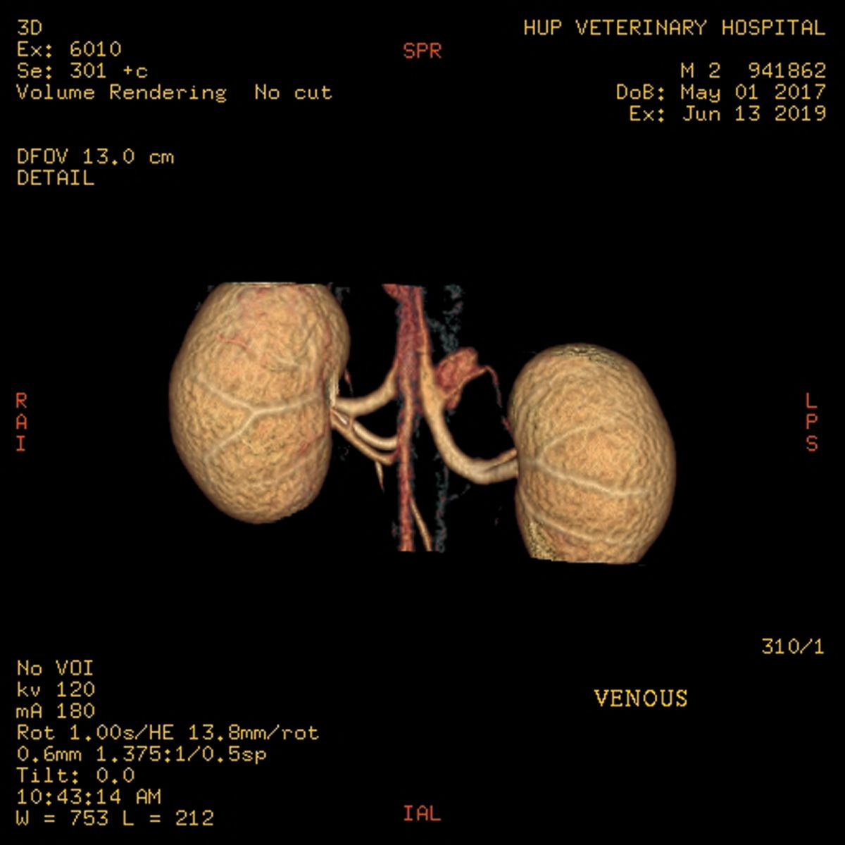 CT– Angiographie einer potenziellen Spenderkatze für eine Nierentransplantation. Die venöse Phase identifiziert links eine einzelne Vene mit kurzer Bifurkation unmittelbar vor dem Eintritt in die Niere. Auf der rechten Seite werden drei Venen identifiziert.