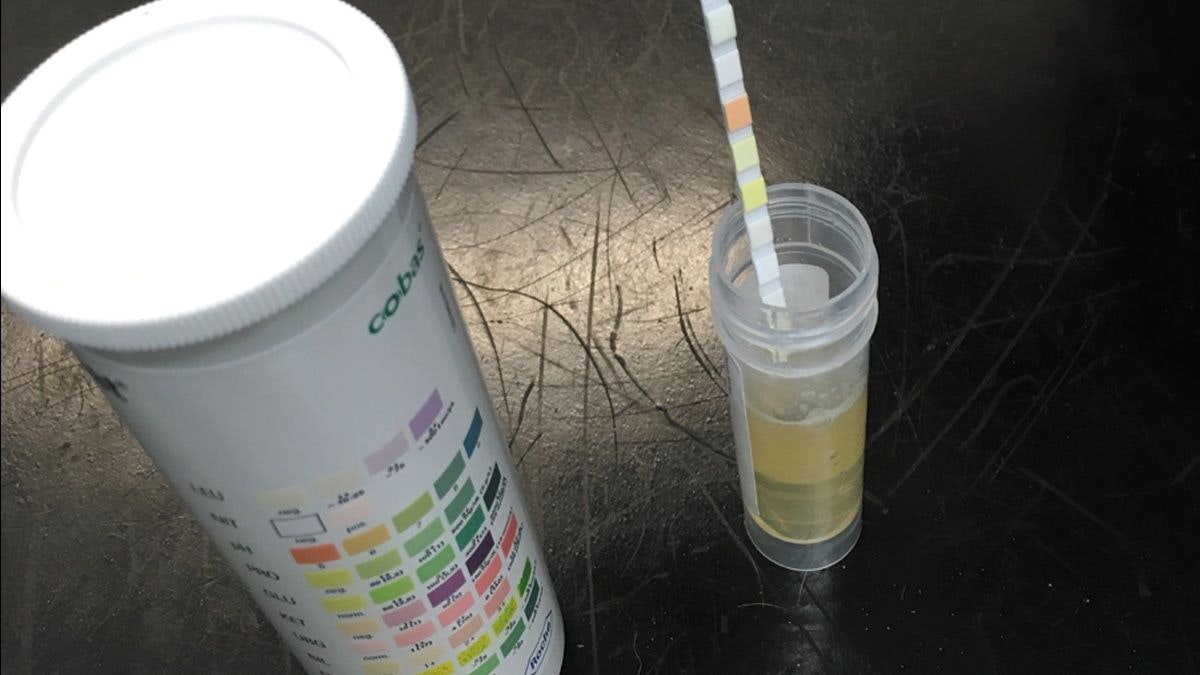 Urinalysis: what can go wrong?