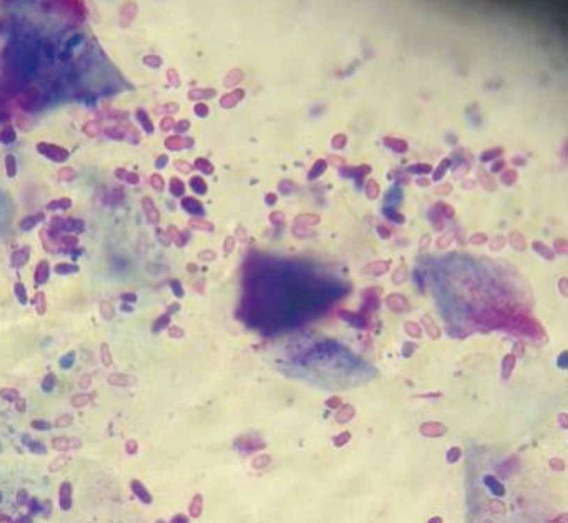 Figure 5. Un nombre lev de Malassezia 
