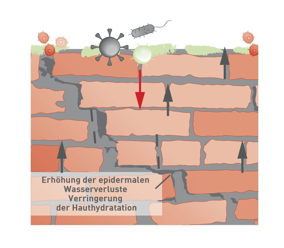 Pathogenese der cAD: interagierende Faktoren