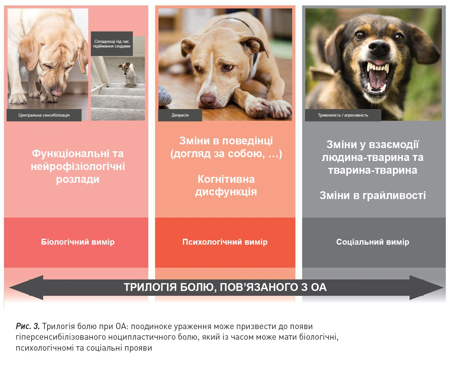 Рис. 3. Трилогія болю при ОА: поодиноке ураження може призвести до появи гіперсенсибілізованого ноципластичного болю