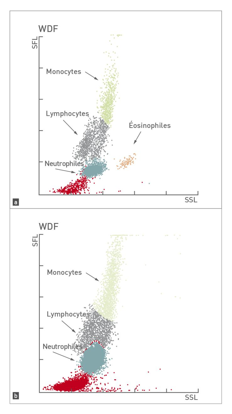 Diagramme de dispersion d’un chien normal comparé à un chien présentant une leucocytose et une déviation vers la gauche