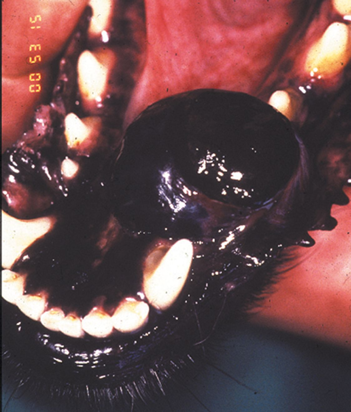 Figure 1. Mélanome pigmenté de la mandibule chez un chien.© D Argyle