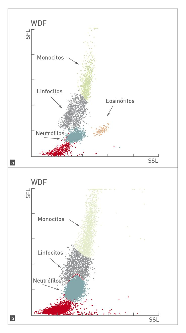 Diagrama de dispersión de un perro normal comparado con un perro con leucocitosis y desviación a la izquierda