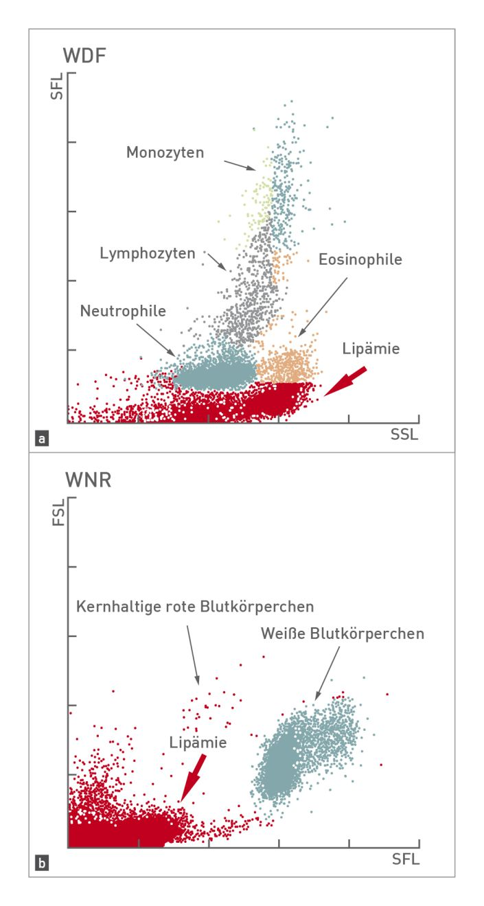 Zwei Zytogramme, die eine Lipämie-Interferenz in einer Leukozytenanalyse zeigen