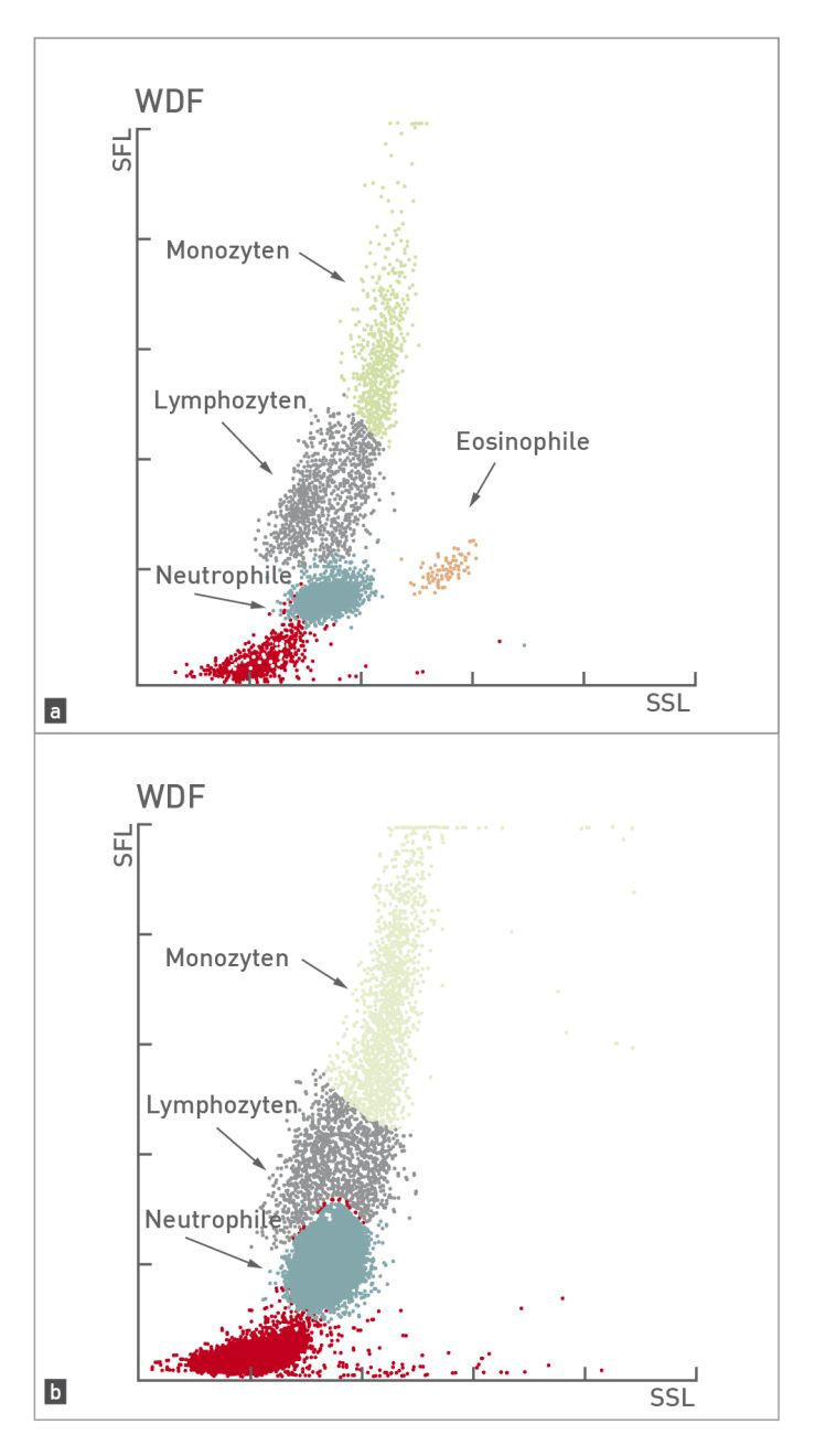 Scattergram eines normalen Hundes im Vergleich zu einem Hund mit Leukozytose und Linksverschiebung