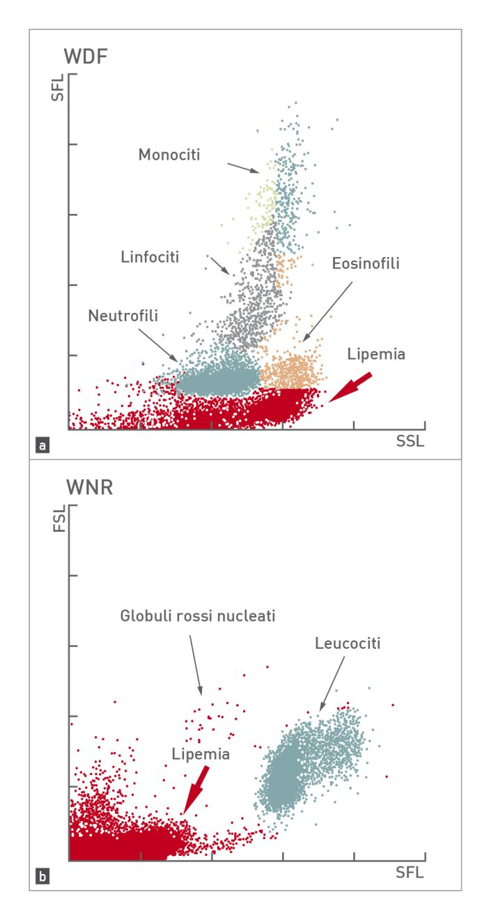 Due diagrammi a dispersione che mostrano l’interferenza della lipemia in un’analisi dei leucociti