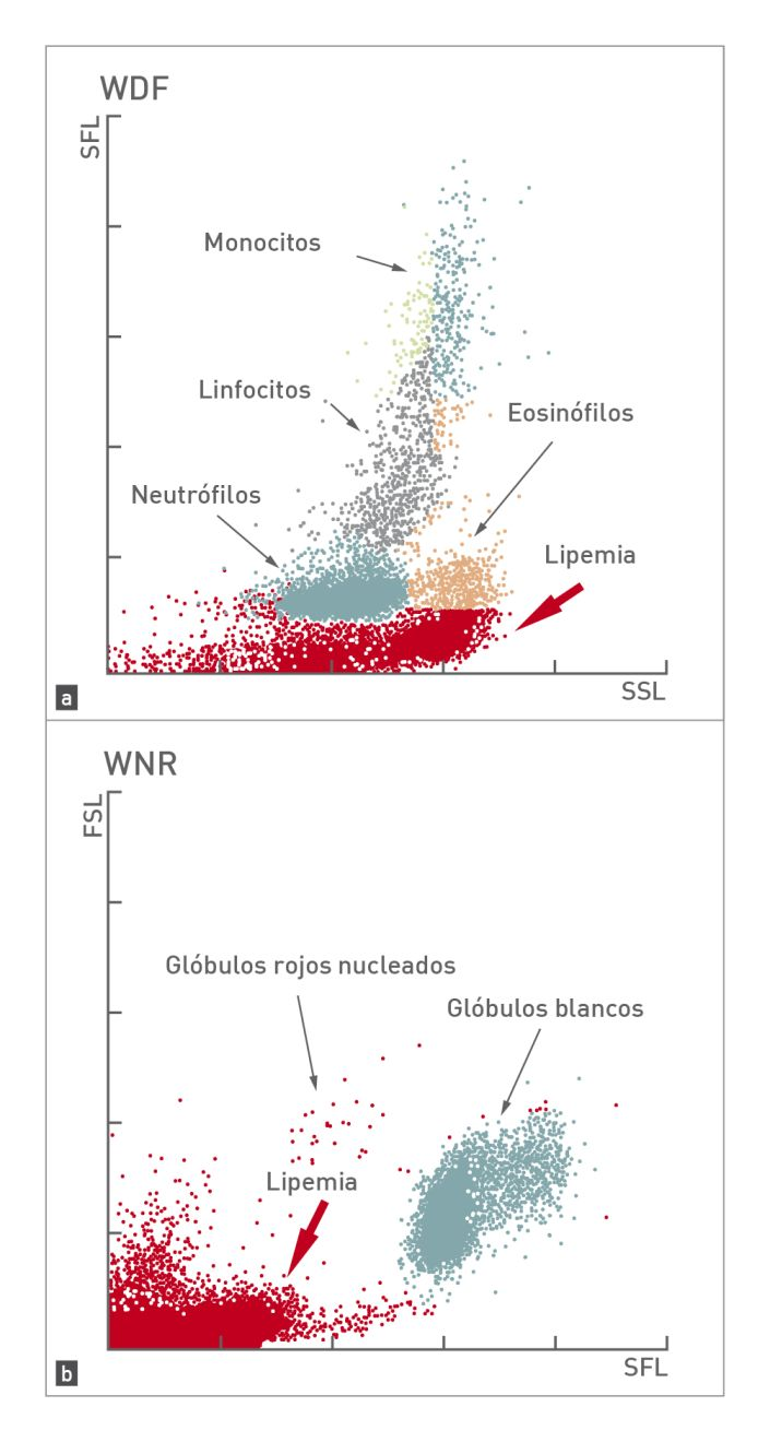 Dos citogramas que muestran la interferencia de la lipemia en un análisis de leucocitos