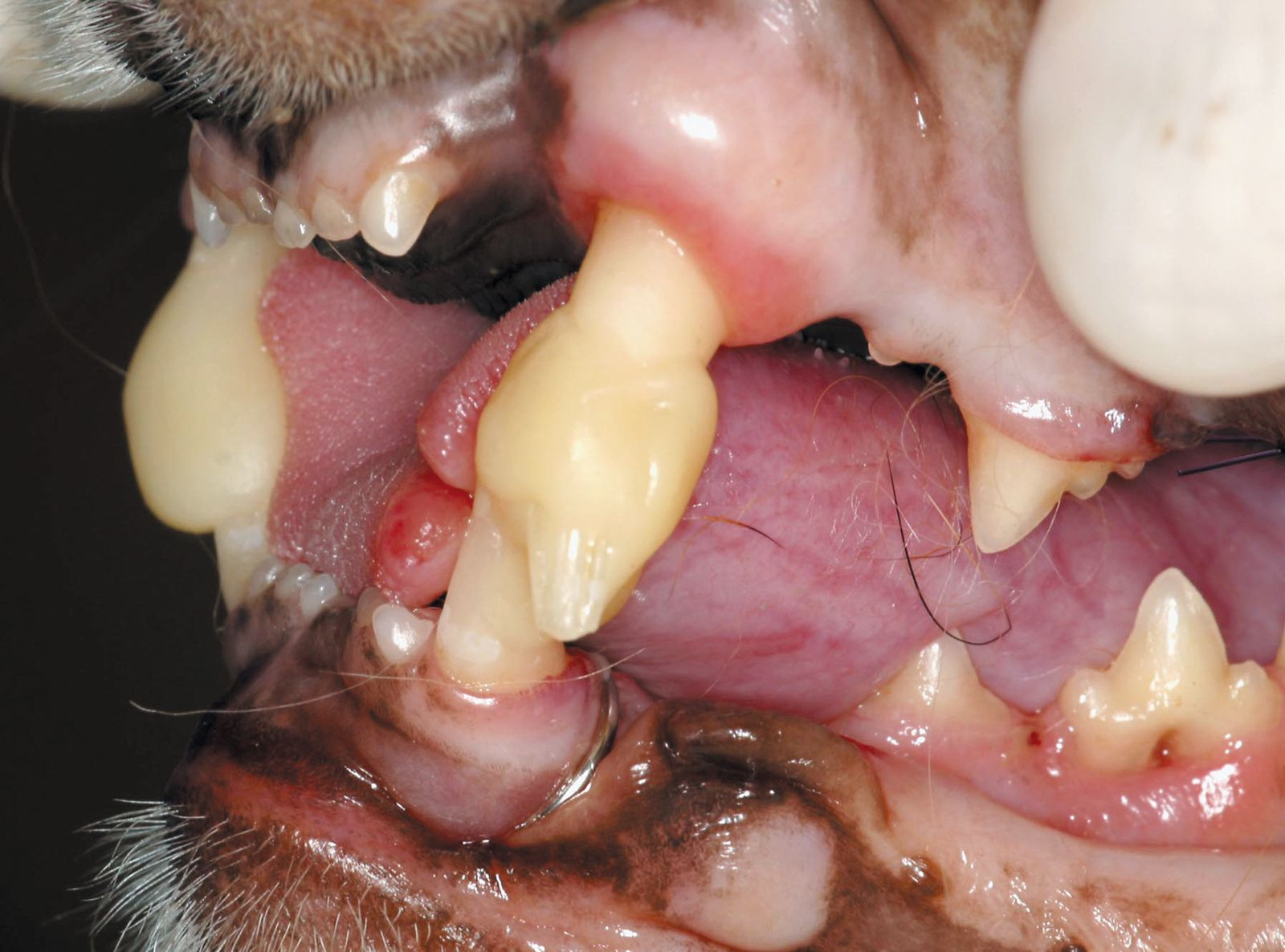 Figure 5. Utilisation d’une résine composite sur les canines