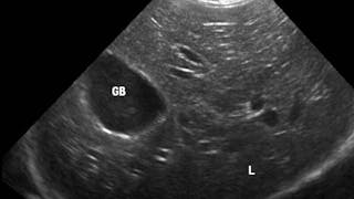 Imaging of the liver and pancreas