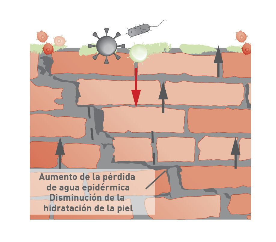 Una barrera epidérmica comprometida puede no impedir eficazmente la penetración de microbios y alergenos