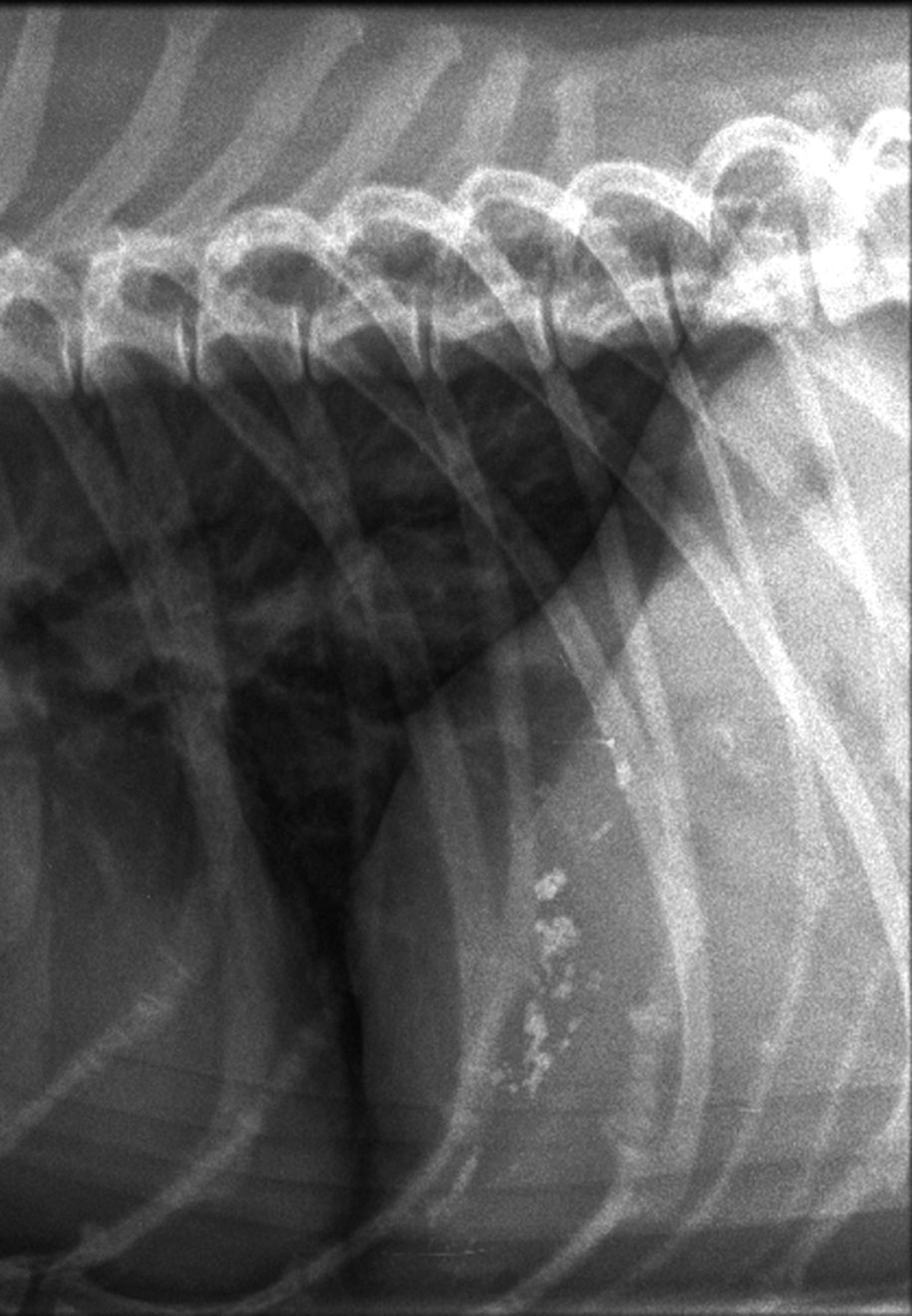 Radiografia addominale laterale che mostra colelitiasi nei dotti biliari intraepatici, con il tipico aspetto ramificato.
