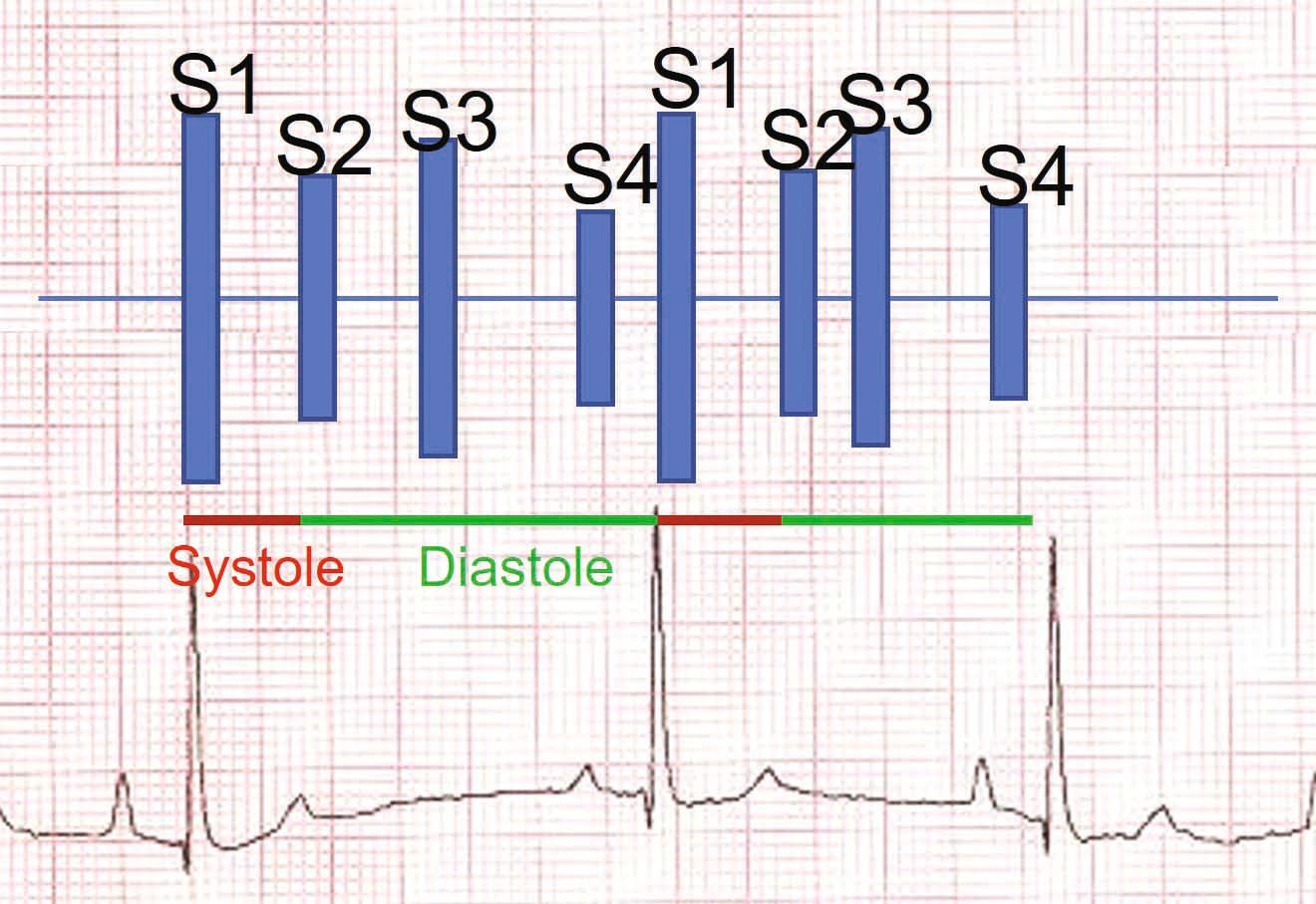 Un bruit de galop à l’auscultation indique généralement la présence d’un dysfonctionnement diastolique ; un bruit de galop est détecté chez 2,6 à 19 % des chats présentant une CMH subclinique [19]. Ce phénomène est rare chez un chat en bonne santé, et sa présence doit toujours inciter à pousser plus loin l’exploration cardiaque.