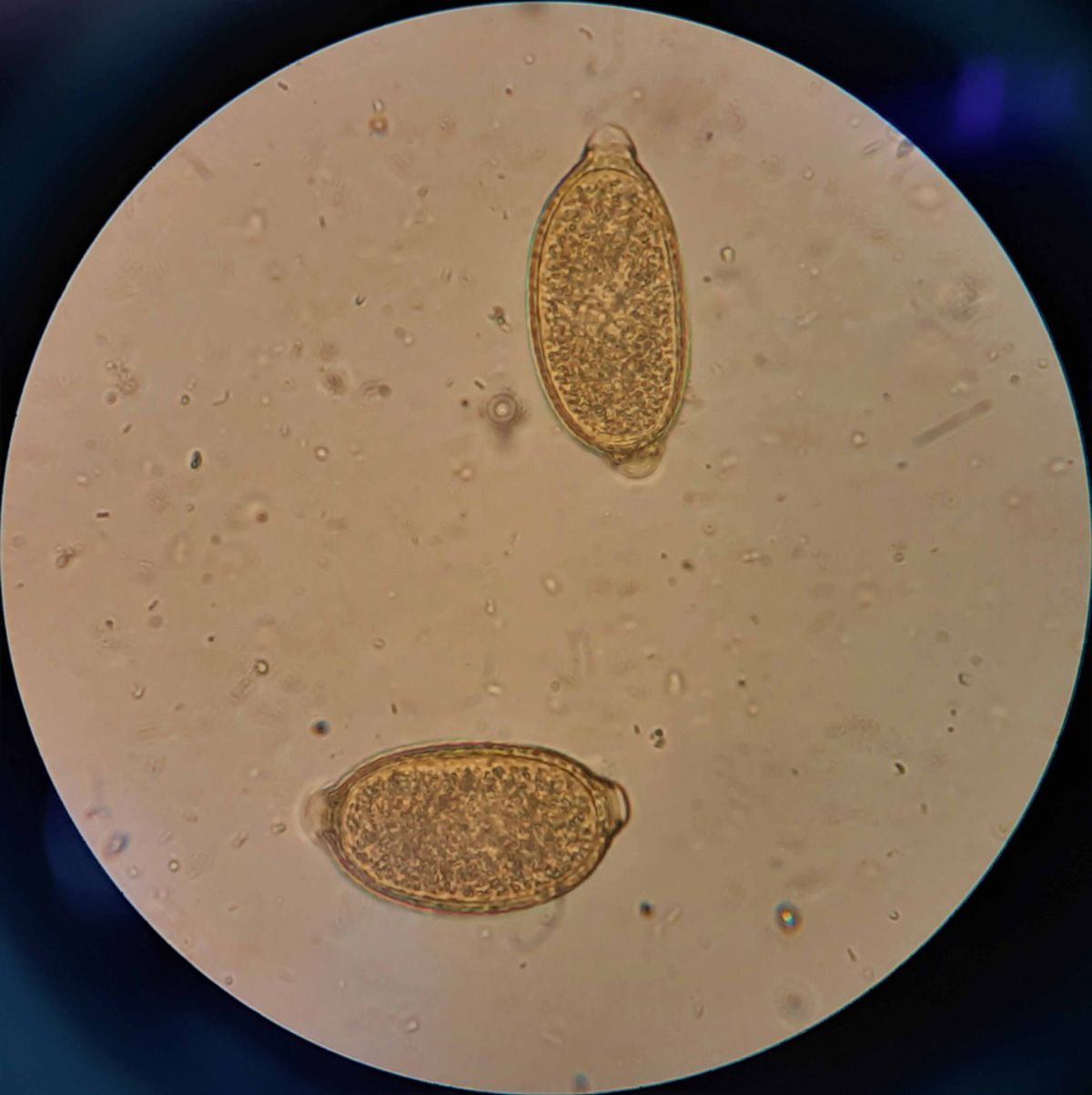 Feline lungworm and heartworm Vet Focus