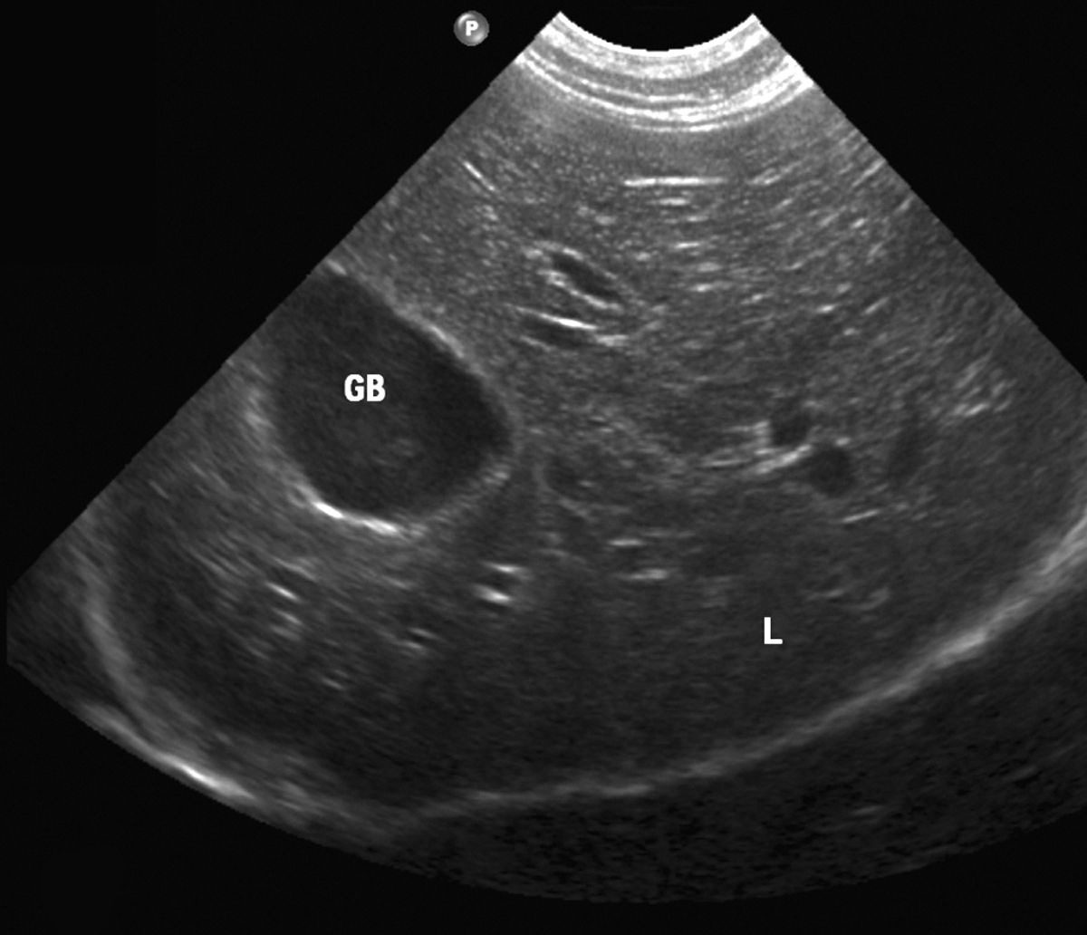 Ecografia di un fegato canino normale. Aspetto della parte destra del fegato in proiezione sagittale.
