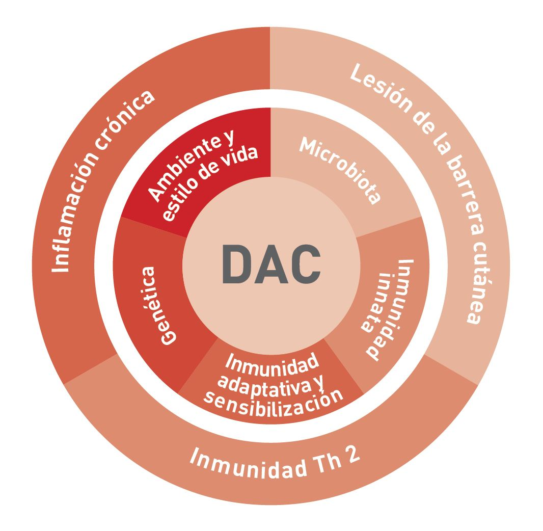 Patogenia de la DAC: varios factores que interactúan