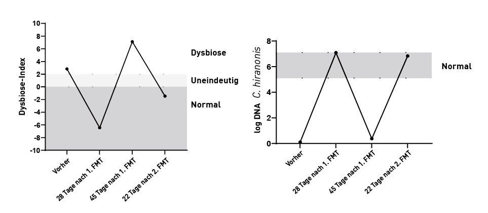 Diese beiden Grafiken stellen den Effekt einer Fäkalen Mikrobiota-Transplantation (FMT) auf das intestinale Mikrobiom dar