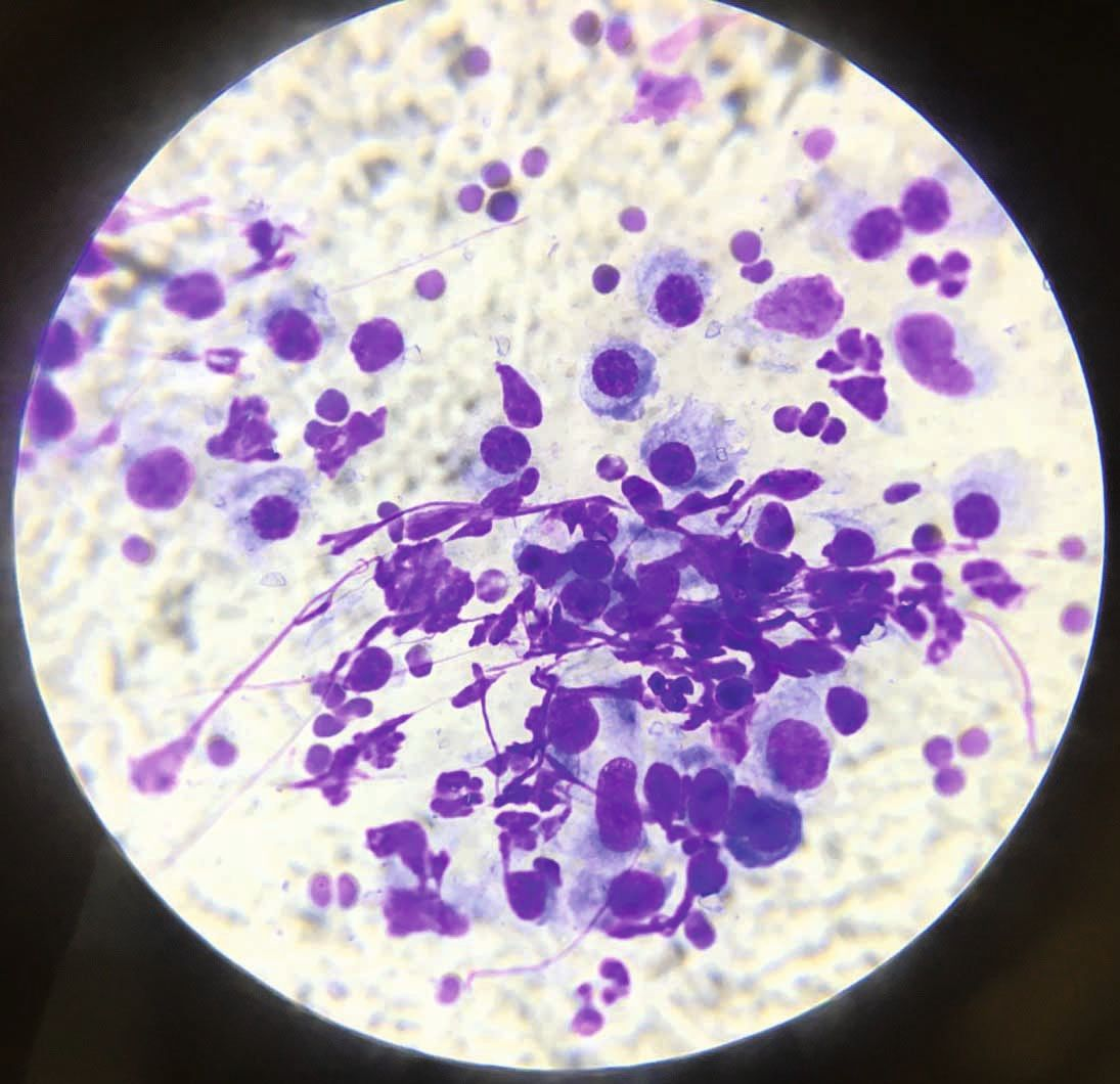 Plasmazelluläre Oropharyngitis Und Pododermatitis Bei Einer Katze – KPVCKS