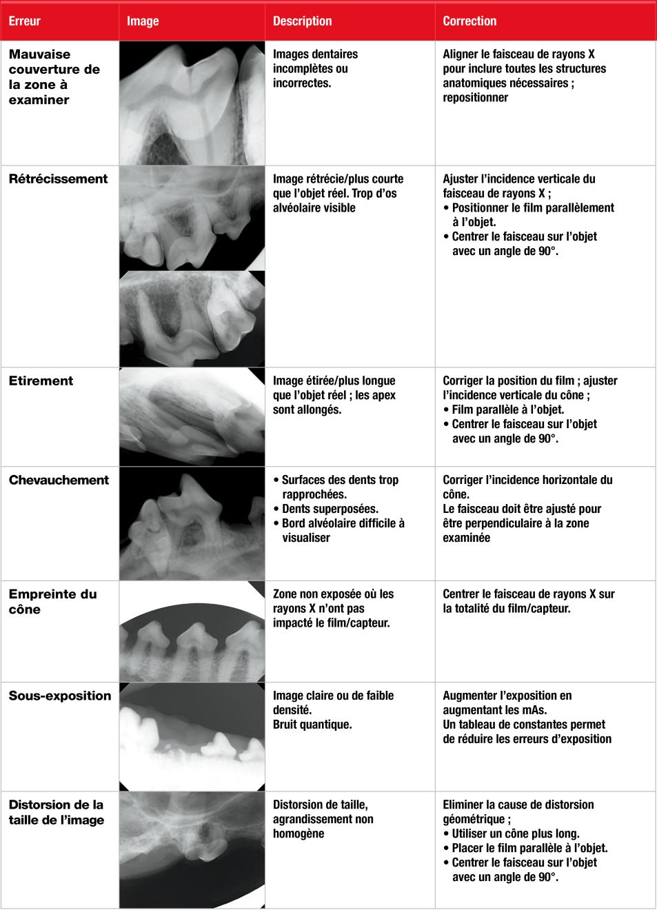 Tableau 1. Erreurs courantes en radiographie dentaire.