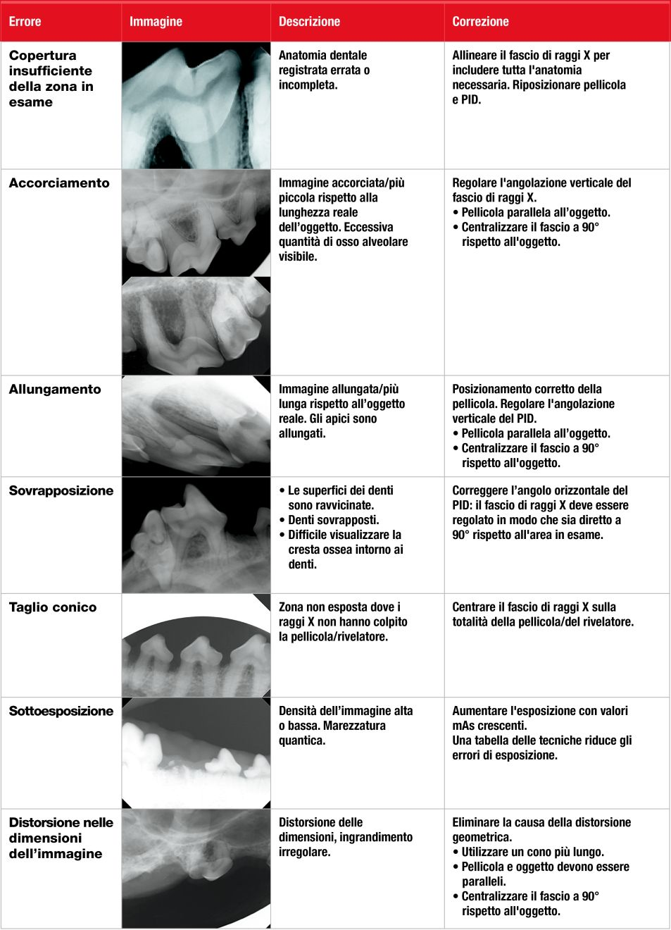 Tabella 1. Gli errori comuni nella radiografia dentale.