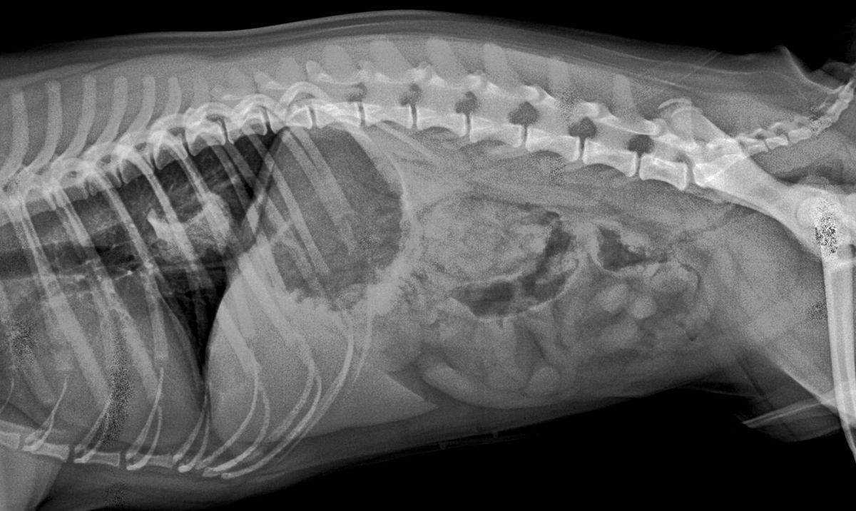 Radiografía torácica del Caso 1 que muestra un cuerpo extraño radiopaco en el esófago distal.