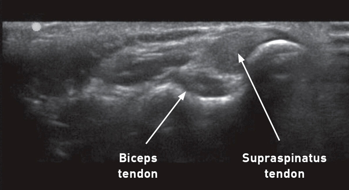 знімок УЗД передньої лапи собаки 